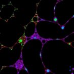 new-bioactive-compounds-target-focal-adhesion-kinase-2