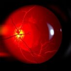 endothelial-activation-links-stress-index-to-diabetic-retinopathy