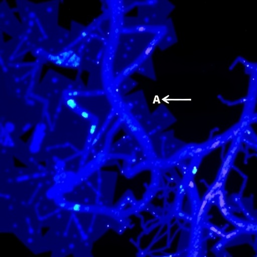 nlrp3-inflammation-regulates-jak2v617f-myeloproliferative-neoplasms