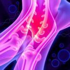 new-insights-on-systemic-sclerosis-from-precisesads