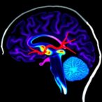 revealing-brain’s-perivascular-spaces-with-5-t-mri