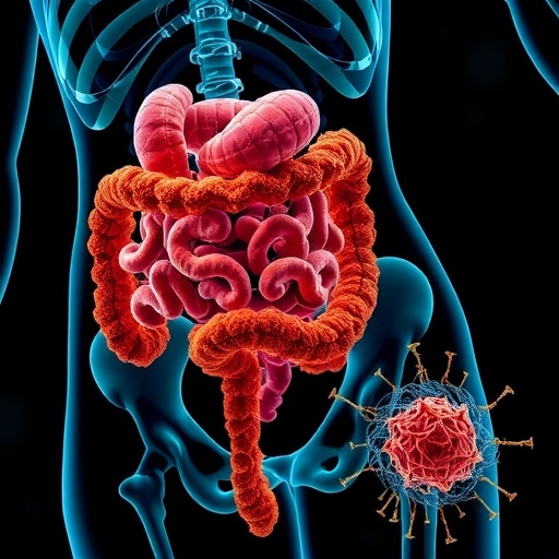 gut-fungi-and-microbes-linked-to-lupus-disease