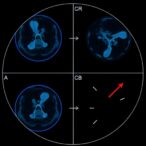 value-based-health-care:-a-radiology-case-study