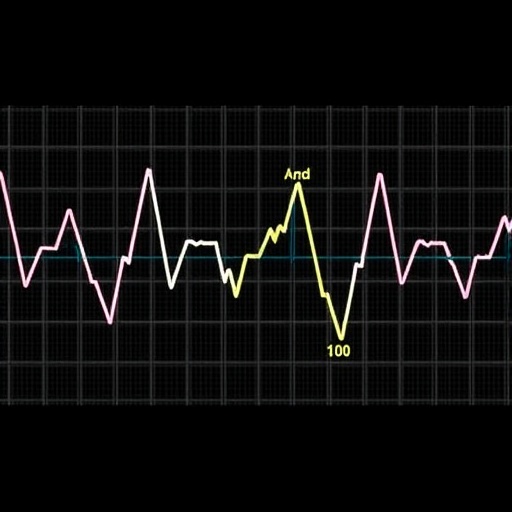continuous-electrocardiographic-index-reveals-sex-differences