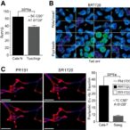 srt1720-alleviates-depression-and-boosts-mitophagy-in-mice