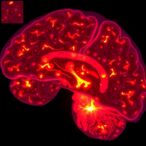 unveiling-p2x7-receptor-in-high-grade-gliomas