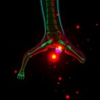 hypoxic-bmscs-enhance-bone-healing-through-m6a-glycolysis