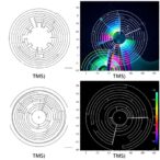 impact-of-tms-coil-types-on-phosphene-threshholds