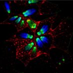 understanding-tnc+-fibroblasts’-role-in-basal-cell-carcinoma