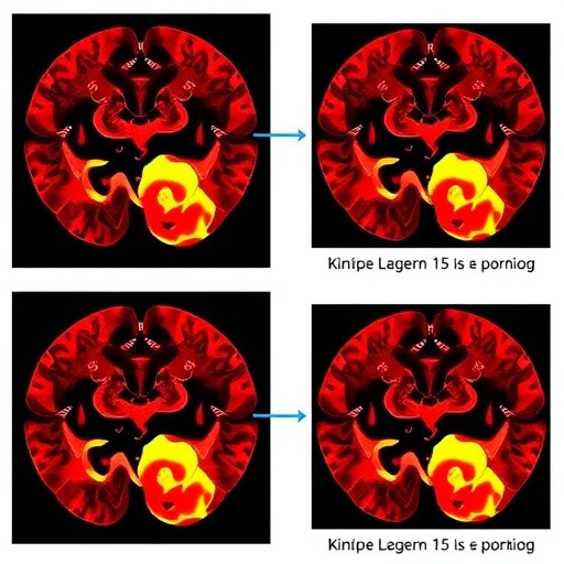 machine-learning-model-to-predict-sarcopenia-in-seniors