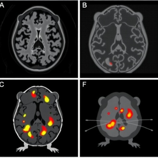 comparing-18f-pet-radiopharmaceuticals-in-alzheimer’s-mouse-model