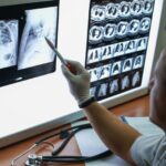 researchers-find-chronic-stress-you-can-see-using-a-ct-scan