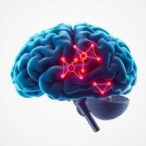 arabinoxylan-enhances-brain-signaling-in-post-stroke-depression