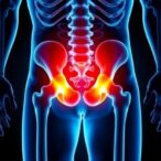 sarcopenia-linked-to-cognitive-decline-post-hip-surgery
