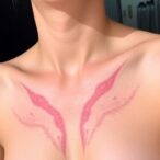 hidradenitis-suppurativa-remission-achieved-using-bacteriophage-therapy