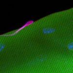 muscle-stem-cells-bolstered-by-ecm-protein-tenascin-c
