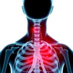 link-between-hla-class-i-alleles-and-tuberculosis-risk