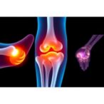 evaluating-pediatric-joint-biopsies:-insights-and-impact