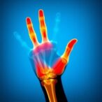 video-quantification-of-hand-tremors-integrated-into-visionmd