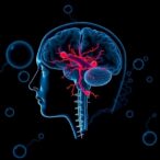 gender-differences-in-aneurysm-rupture-symptoms-revealed