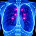 boosting-breast-cancer-detection-with-advanced-ai-techniques