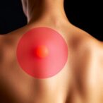 drug-induced-skin-toxicities-in-solid-tumors-explained