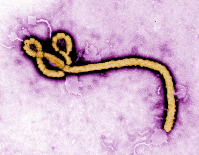 ebola-and-marburg-induced-gut-damage-modeled-using-organoids
