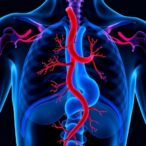 glp-1-agonist-trial-in-large-vessel-occlusion