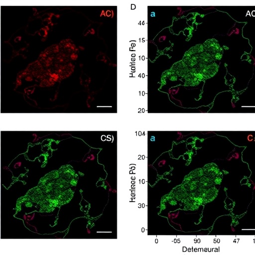 hdac2-boosts-hepatocellular-carcinoma-via-chromatin-remodeling