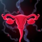 mmp-9-dysregulation-links-ovulatory-dysfunction-in-pcos
