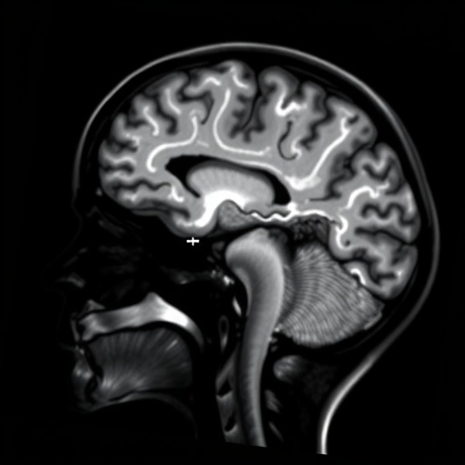 advancing-neonatal-brain-prognosis-with-diffusion-kurtosis