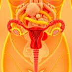 metabolic-syndrome-fuels-endometrial-cancer-via-oleic-acid