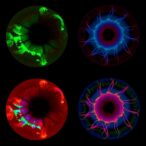 transforming-color-fundus-photos-into-fluorescein-angiography