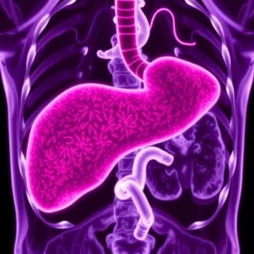 new-trial-combines-sbrt,-sintilimab,-bevacizumab-in-liver-cancer