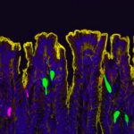 does-estrogen-increase-chronic-gastrointestinal-pain?