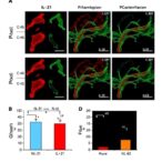 il-21-boosts-immunosuppression-in-chronic-hbv-liver-inflammation