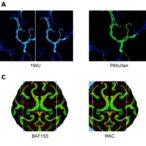 baf155-drives-brain-myelination,-autism-behaviors-in-mice