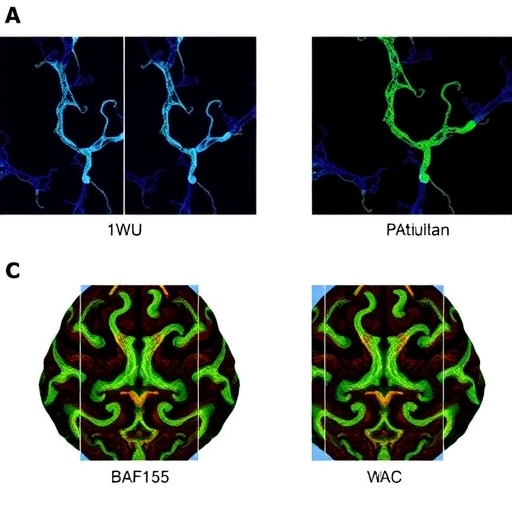baf155-drives-brain-myelination,-autism-behaviors-in-mice