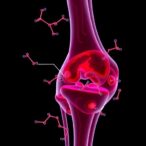 staphylococcus-fatty-acids-control-joint-infection-aggregation