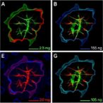 antisense-therapy-reverses-developmental-defects-in-sma-organoids
