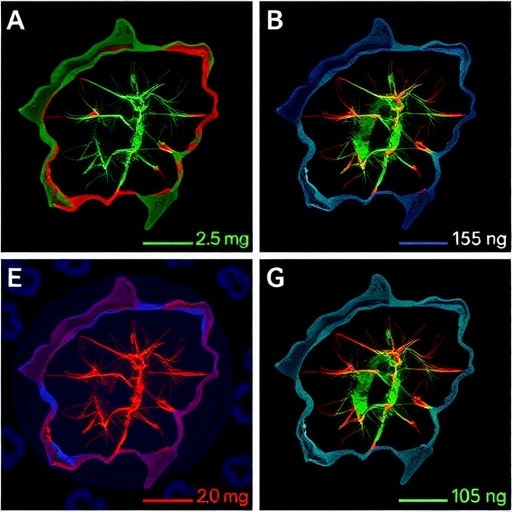 antisense-therapy-reverses-developmental-defects-in-sma-organoids