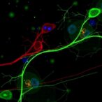 lrrk2-mutation-causes-neurodegeneration-via-microglial-inflammation