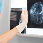 hologic-breast-cancer-study-bolsters-use-of-mammogram-ai