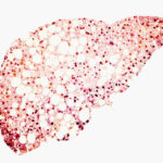 high-fat-diet-triggers-hepatocyte-dedifferentiation-and-cancer-risk