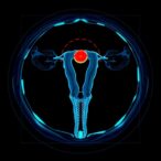 revolutionary-micro-ct-and-ai-evaluate-ovarian-follicles