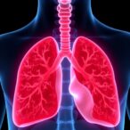 new-phase-2-trial-boosts-stage-iii-nsclc-treatment