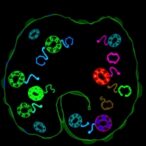 gpr4-drives-immune-exclusion-via-loxl2-in-colon-cancer