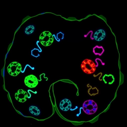 gpr4-drives-immune-exclusion-via-loxl2-in-colon-cancer