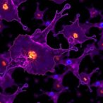 intraperitoneal-mrna-car-macrophages-boost-cancer-therapy
