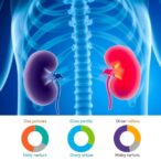 bisphosphonates’-impact-on-kidney-function-in-elderly-osteoporotics